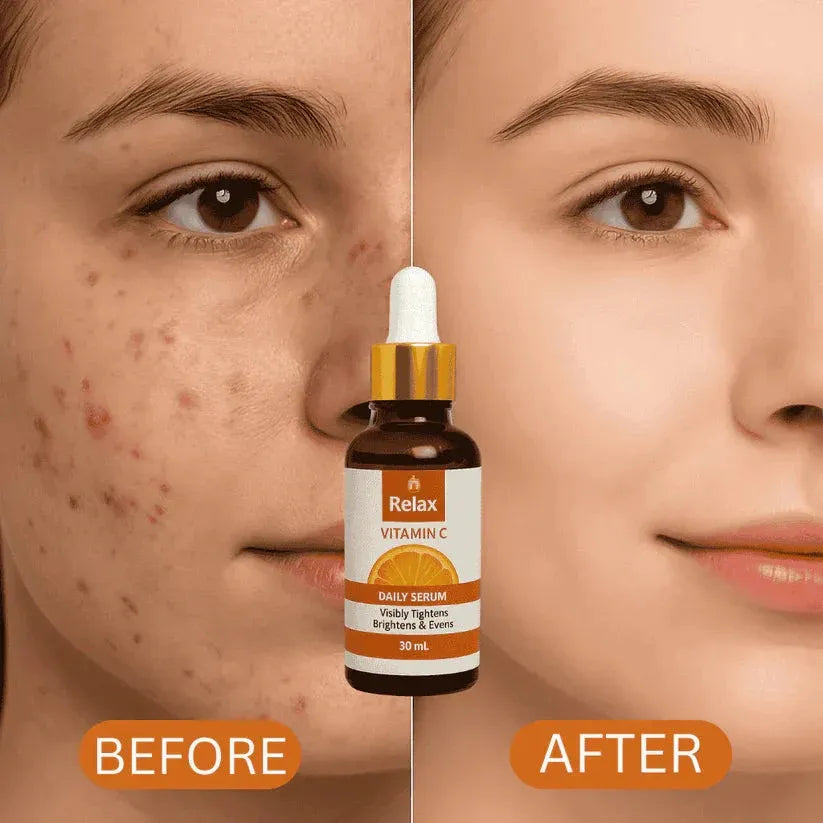 Relax Vitamin C Daily Serum Buy 1 Get 1 Free