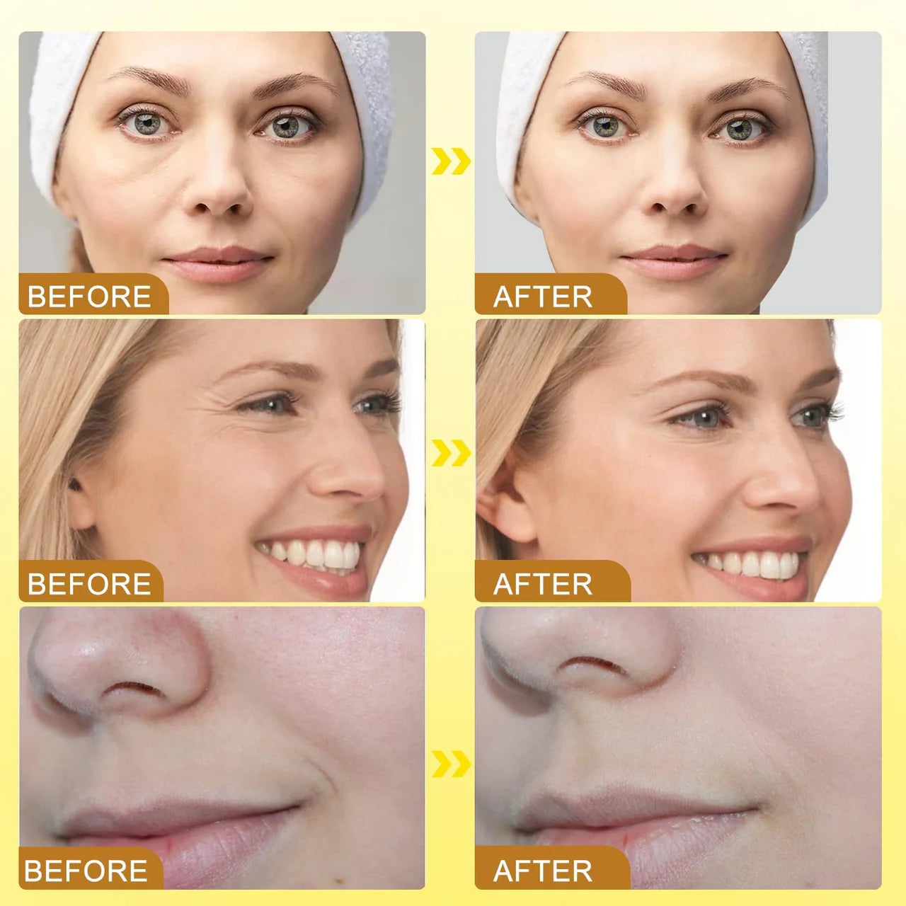 Bee Venom Wrinkle Removal Cream Buy 1 Get 1 Free
